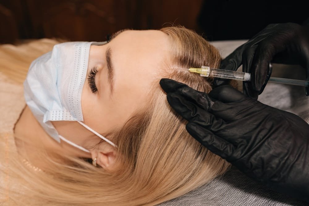 The Top 5 Benefits of PRP Hair Restoration for San Diego Residents