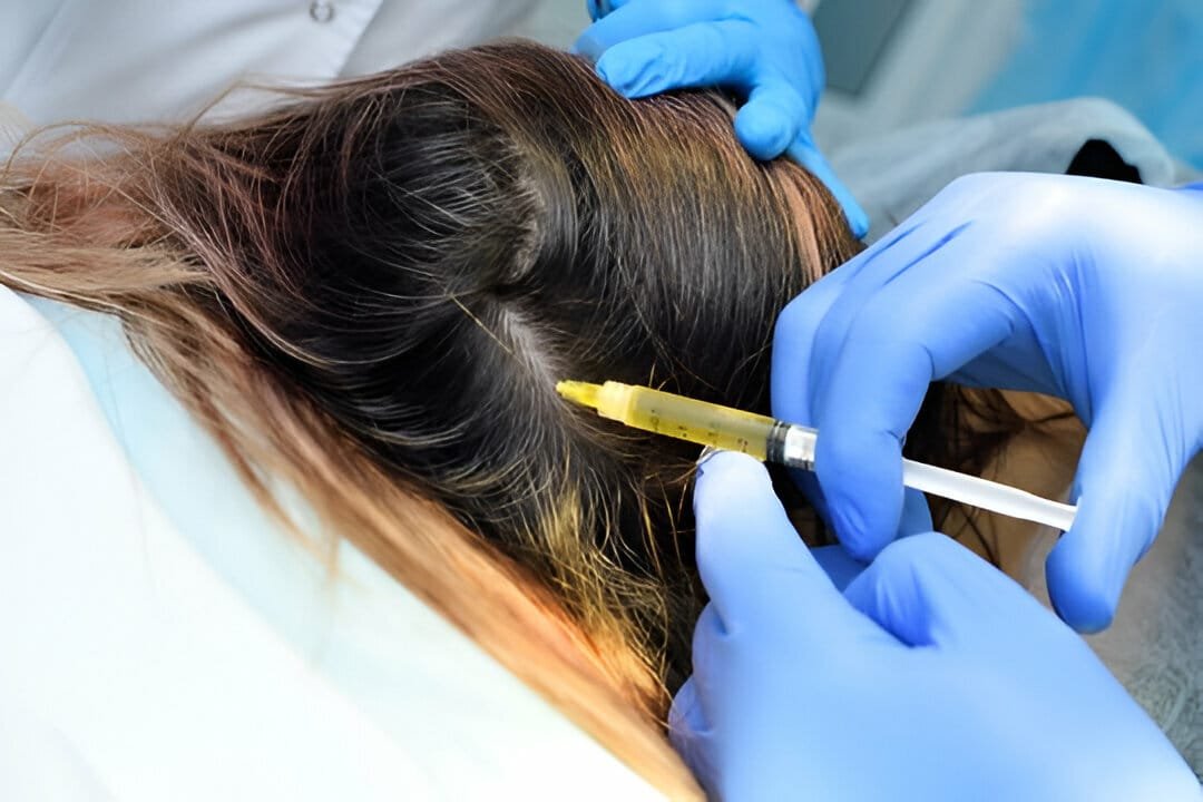 Top Advanced Hair Loss Treatments Available in San Diego