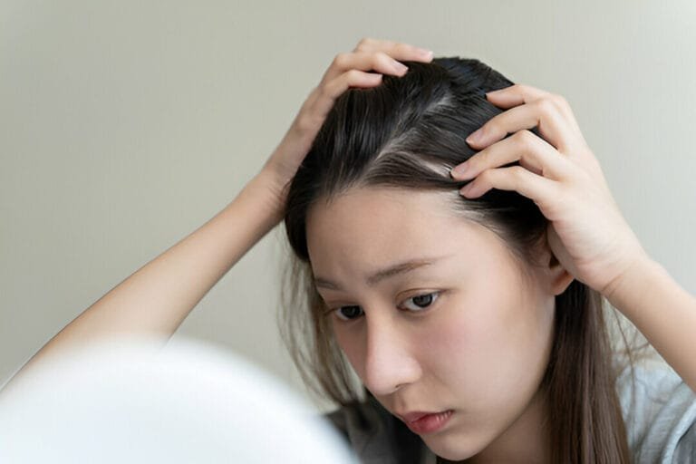 Hormones-and-Hair-Loss-Why-PRP-May-Be-the-Answer-for-Women-in-San-Diego